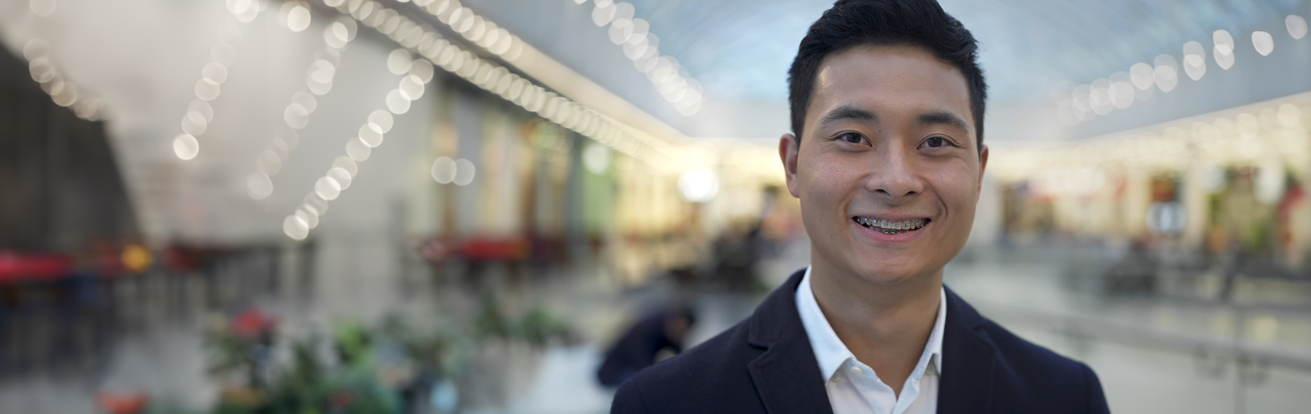 Magic Touch Orthodontist | Open Bites, Reverse Underbites and Orthodontic br  Emergencies