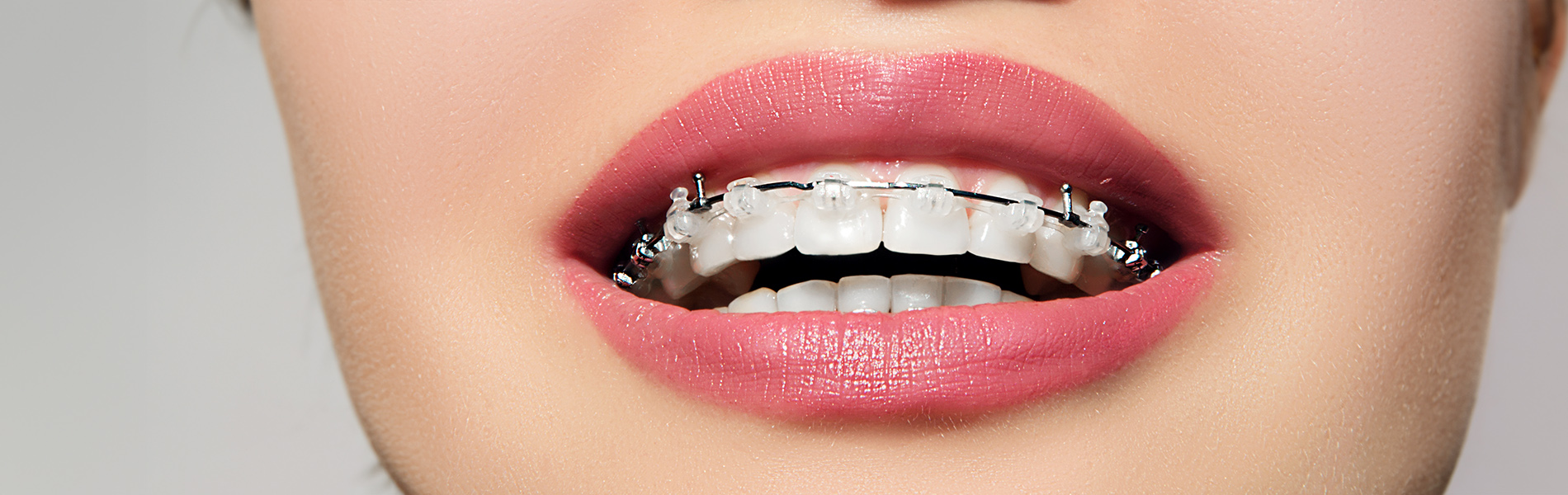 Magic Touch Orthodontist | Clear Aligners, Orthodontics for Children and Finger Habits