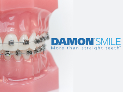 Magic Touch Orthodontist | Sports Mouthguards, Damon Braces and Traditional Metal Braces