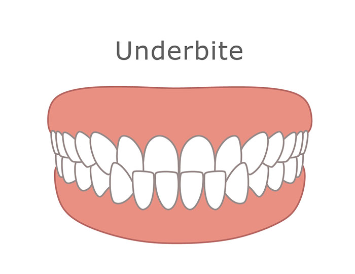 Magic Touch Orthodontist | Early or Late Loss of Baby Teeth, Excessive Spacing and Orthodontics for Teens