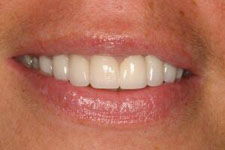 Magic Touch Orthodontist | Orthodontics for Adults, Orthodontics for Teens and Sleep Apnea