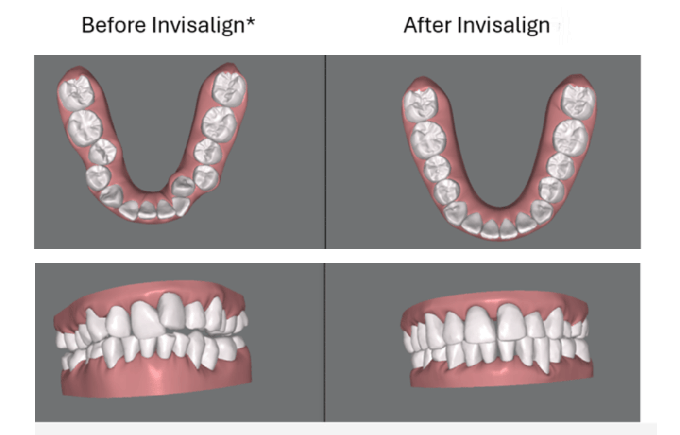 Magic Touch Orthodontist | Crowding, Facial Imbalance and Orthodontics for Teens