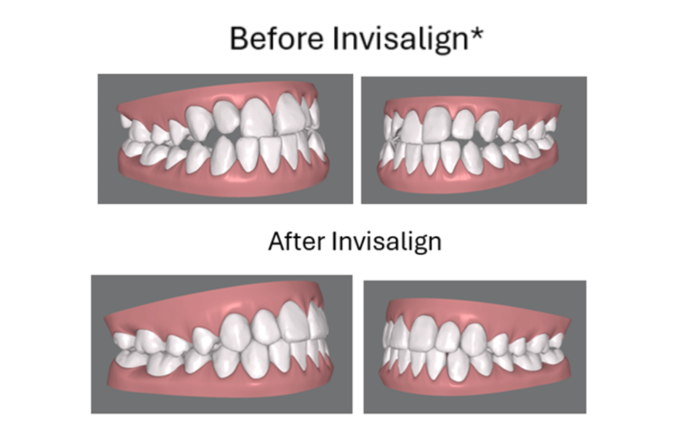 Magic Touch Orthodontist | Malocclusions & Corrections, Facial Imbalance and Damon Braces