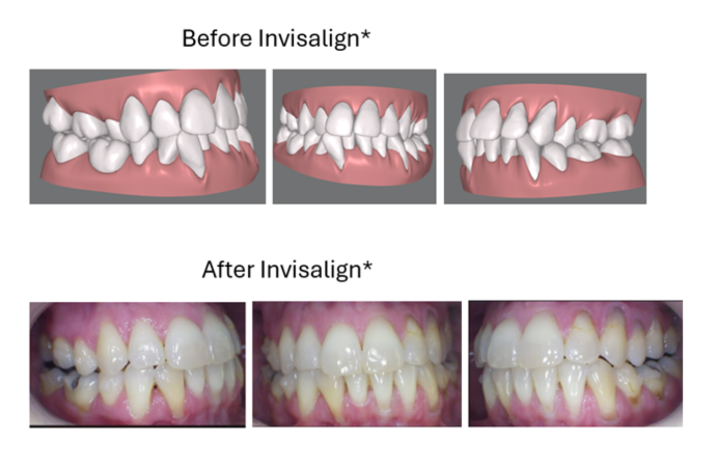 Magic Touch Orthodontist | Finger Habits, Excessive Spacing and Facial Imbalance