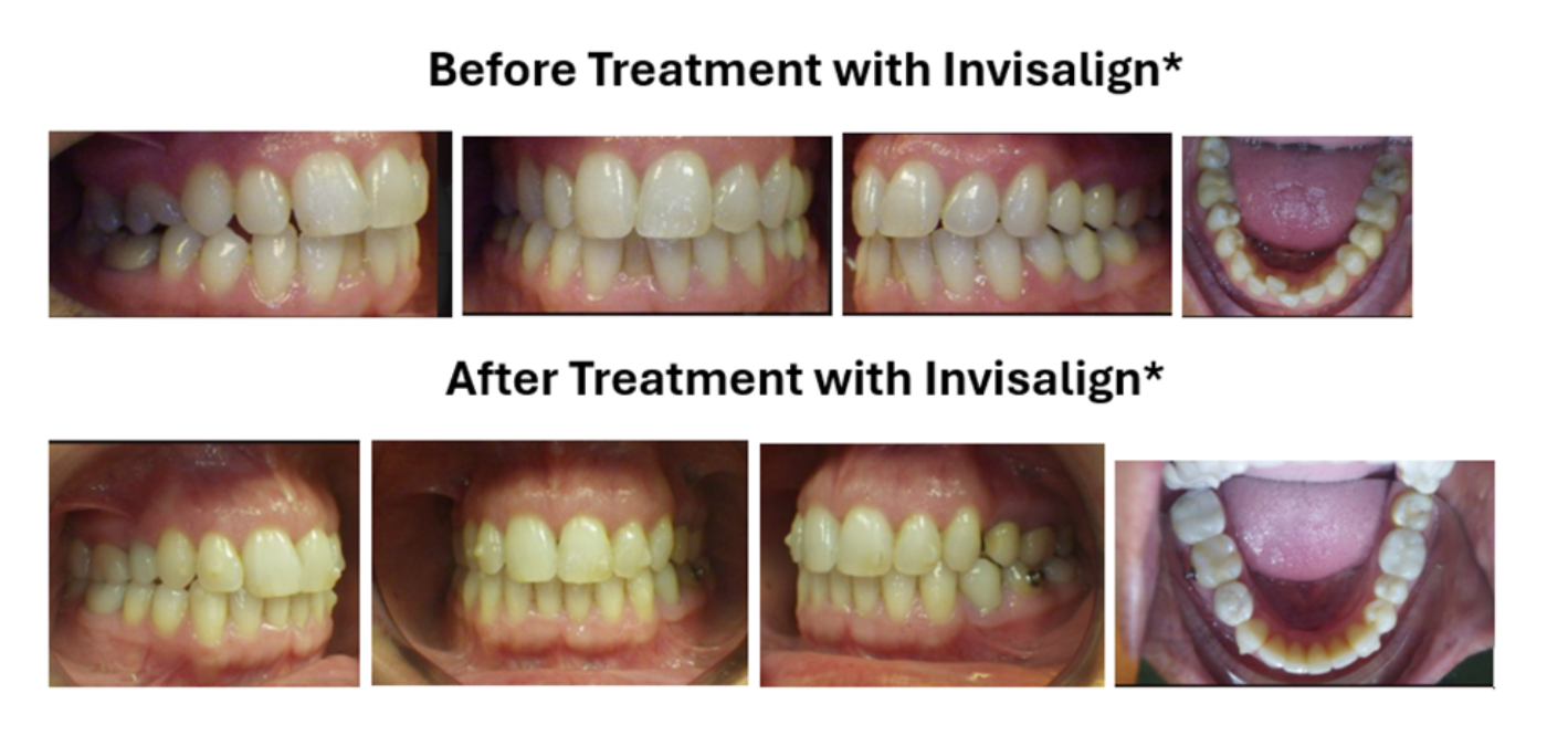 Magic Touch Orthodontist | Night Guards, Orthodontics for Children and Sleep Apnea