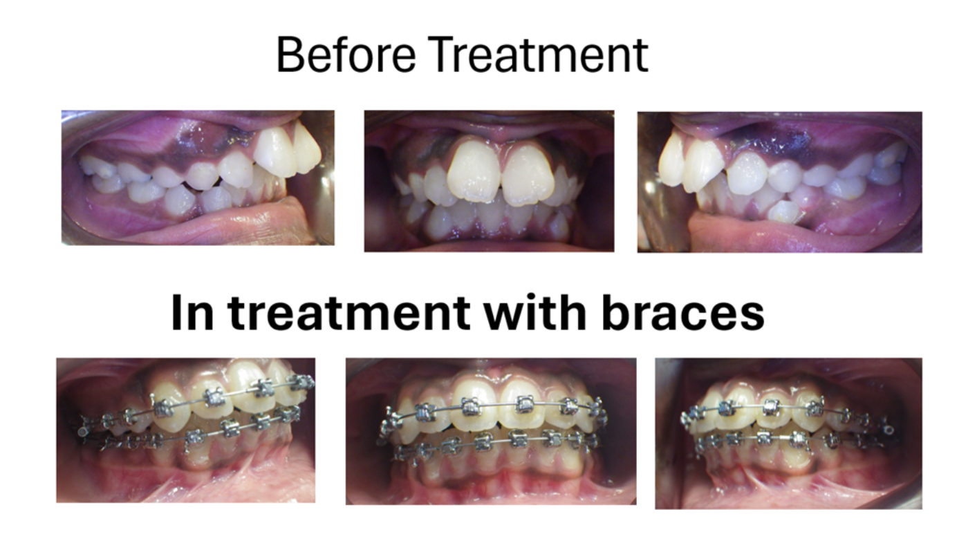 Magic Touch Orthodontist | Jaw Surgery, Early or Late Loss of Baby Teeth and Malocclusions   Corrections