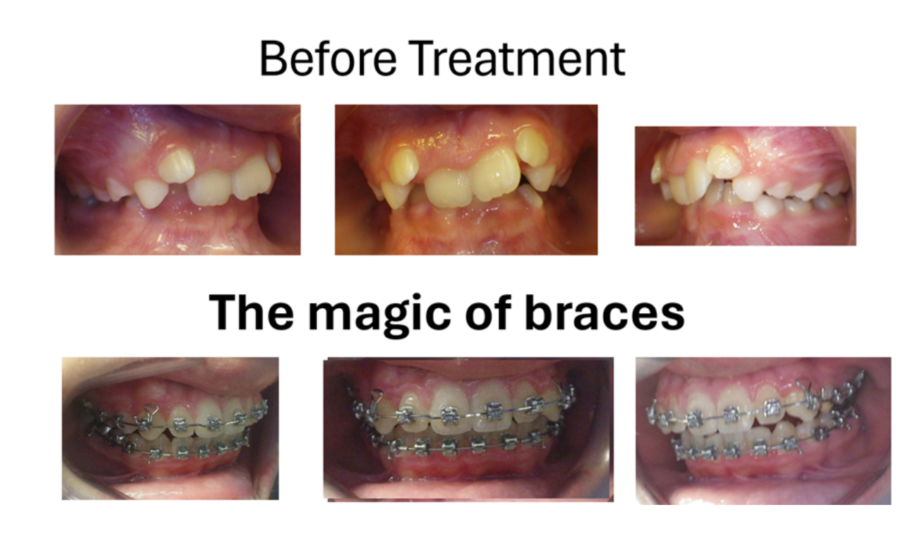 Magic Touch Orthodontist | Pain Behind the Eyes, Orthodontic Emergencies and Damon Braces