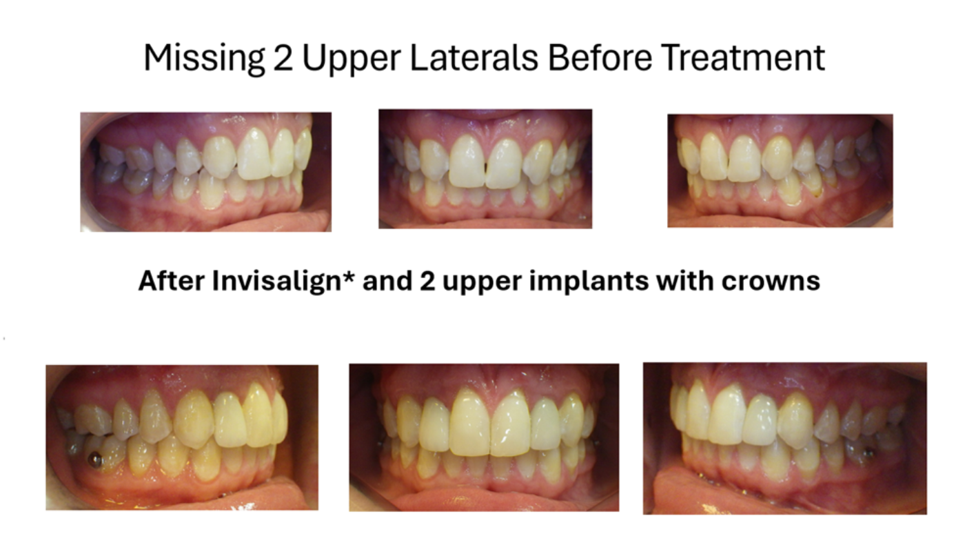 Magic Touch Orthodontist | Clear Aligners, Finger Habits and TMJ/Migraine Headaches/MPD